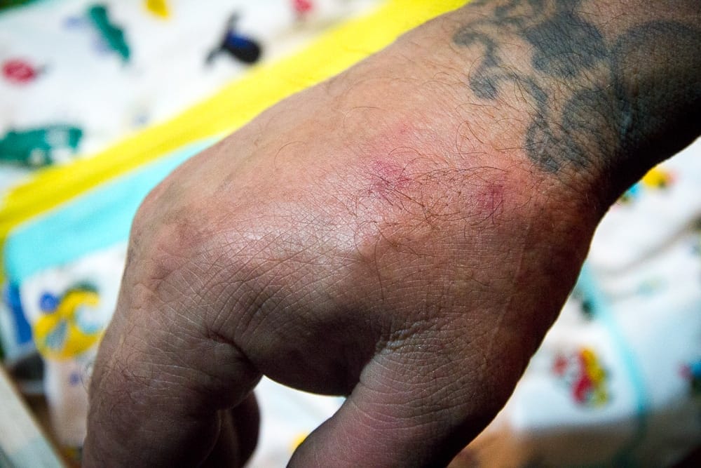 Yanshui Fireworks Festival injuries